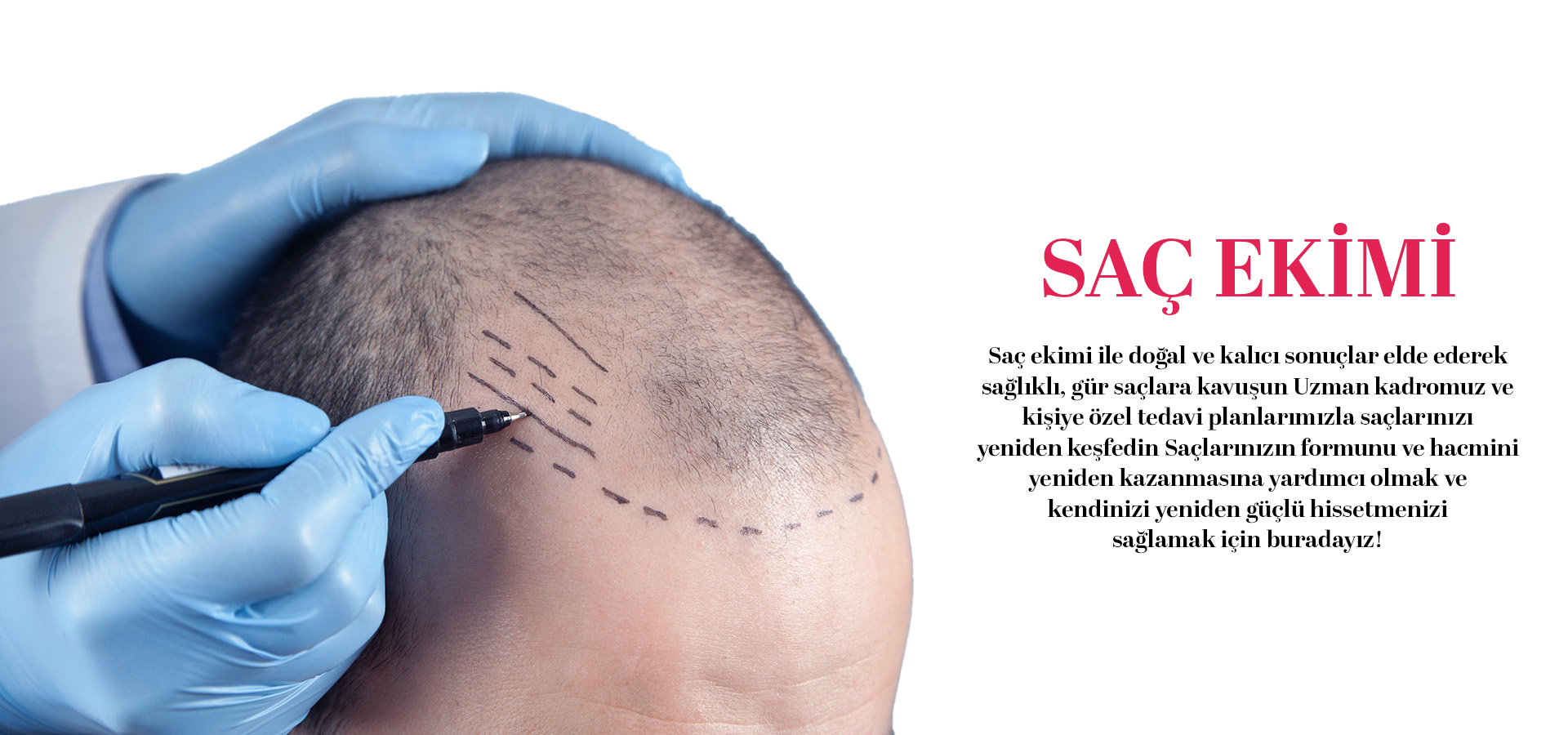 AYZ Clinic Slider Sayfa 3.